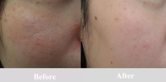 时代进步下的白癜风治疗革新,最新疗法探讨