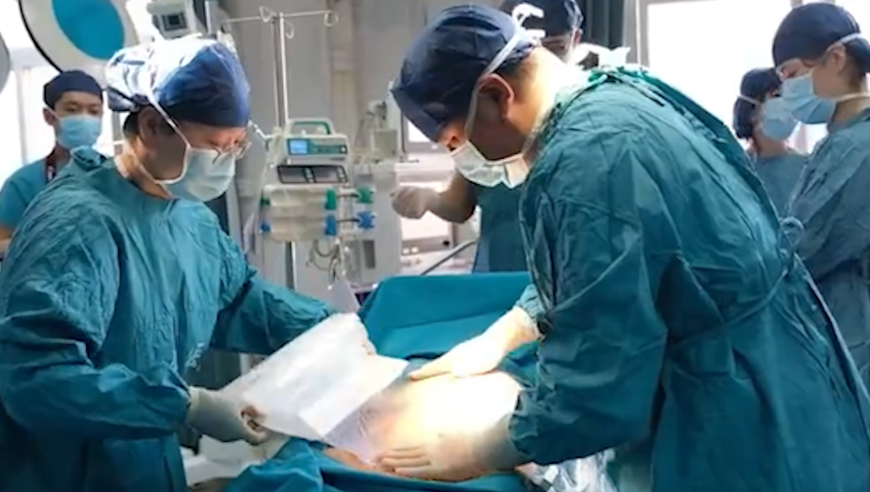 人造肾最新进展与步骤指南，揭秘2024最新消息