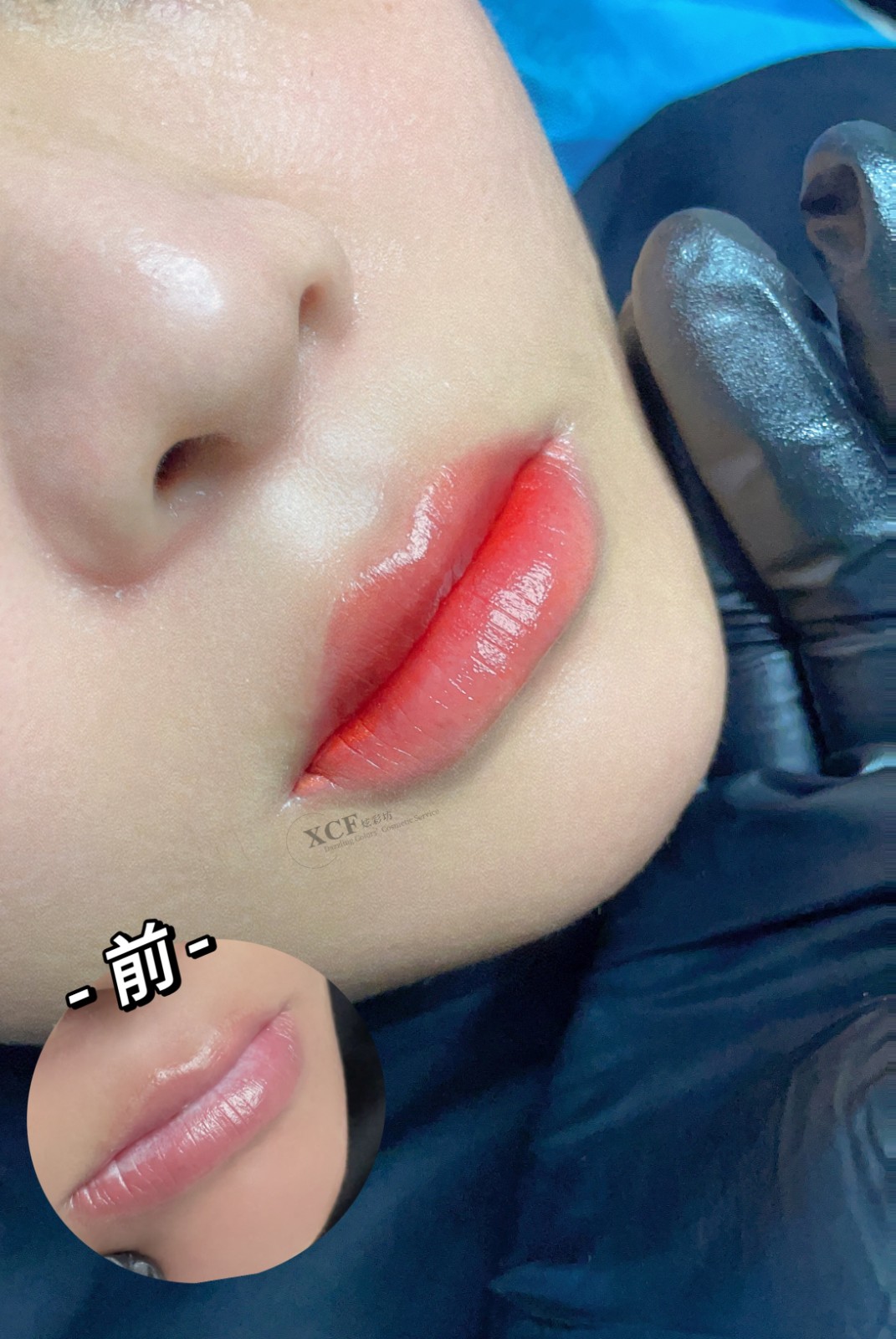 唇部最新技术，开启自然美景探索之旅